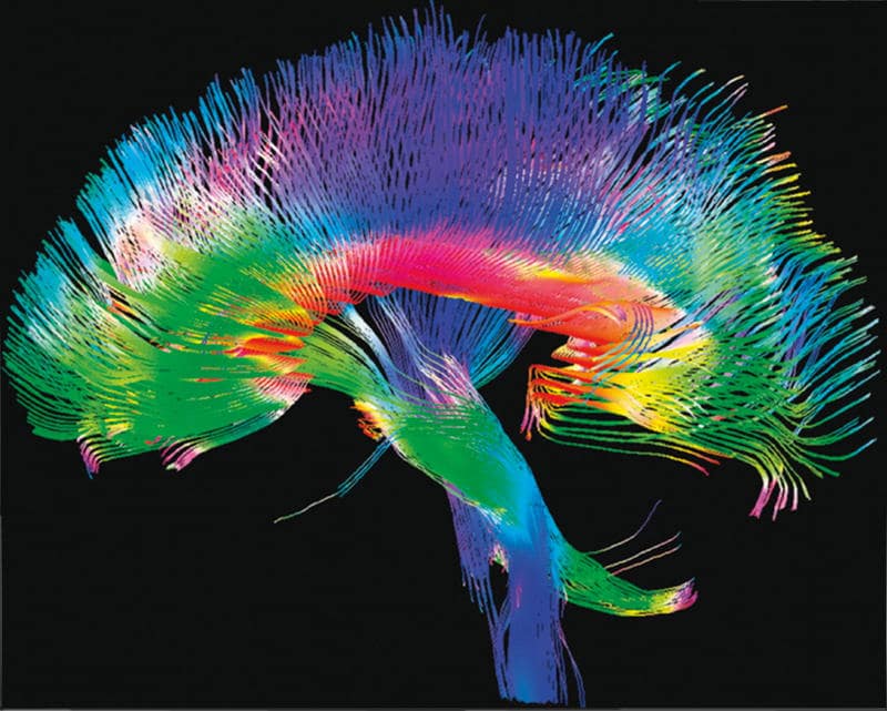 Cerebro Mapa de conexiones cerebrales.