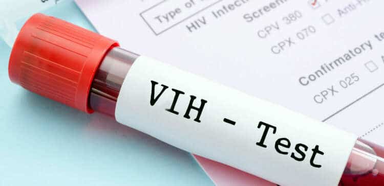 Anticuerpo podrí­a destruir hasta el 99% de las cepas del VIH (SIDA).