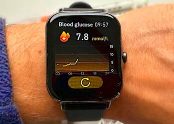 Reloj Monitor Azucar En La Sangre - azúcar en la sangre