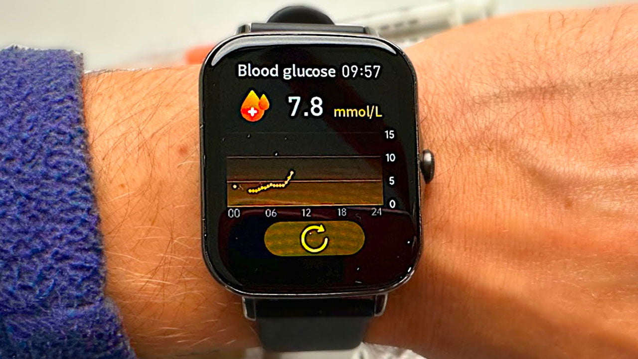CES2021, aquí está el reloj inteligente que puede medir el azúcar en sangre sin  agujas